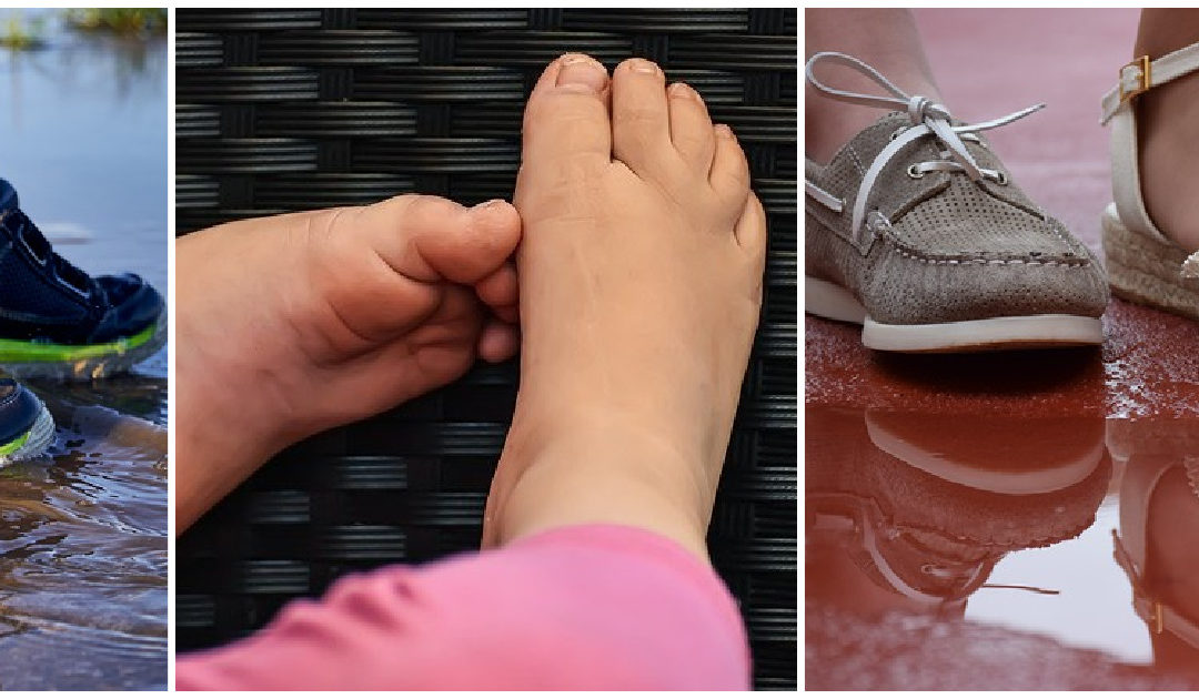 Parental perspectives of foot-care and footwear in children and young people with learning disabilities