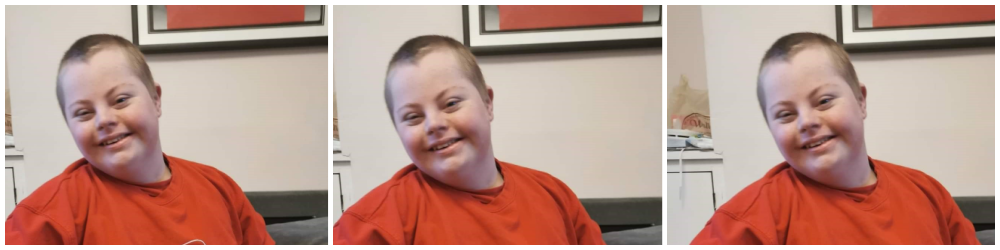 Down’s Syndrome, Autism and Me