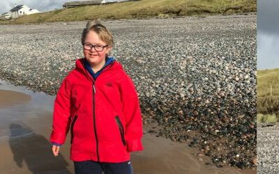 Down’s syndrome with complex needs case study: Jamie